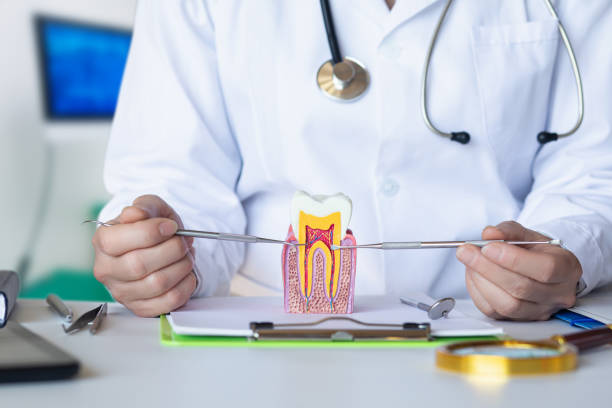 Best Emergency Root Canal Treatment in Wollochet, WA