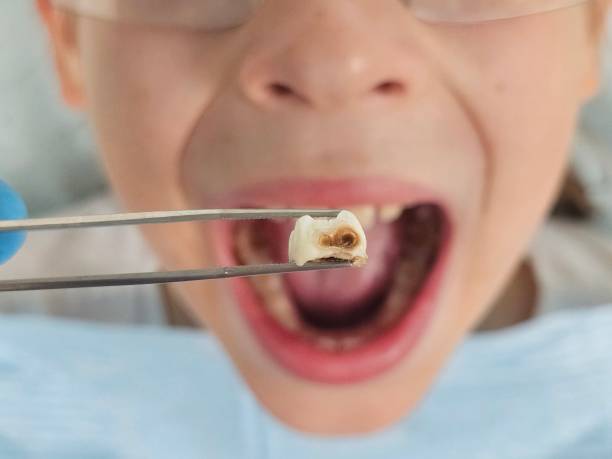 Best Emergency Orthodontic Repairs in Wollochet, WA